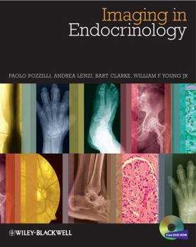 Hardcover Imaging in Endocrinology Book