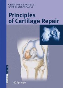 Hardcover Principles of Cartilage Repair Book