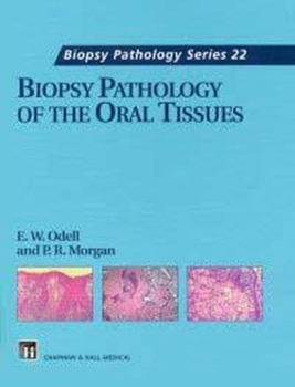 Hardcover Biopsy Pathology of the Oral Tissues Book