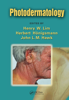 Paperback Photodermatology Book