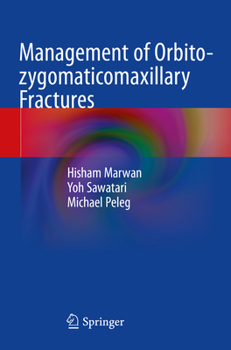 Paperback Management of Orbito-Zygomaticomaxillary Fractures Book