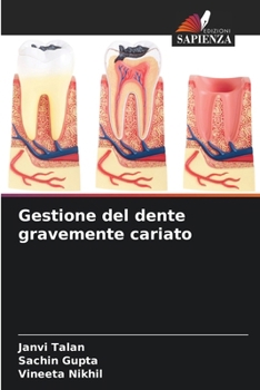 Paperback Gestione del dente gravemente cariato [Italian] Book