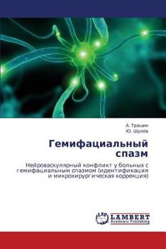Paperback Gemifatsial'nyy Spazm [Russian] Book