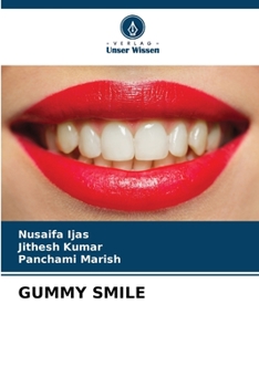 Paperback Gummy Smile [German] Book