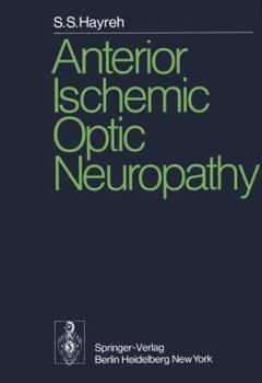 Paperback Anterior Ischemic Optic Neuropathy Book