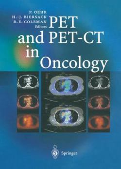 Hardcover Pet and Pet-CT in Oncology Book