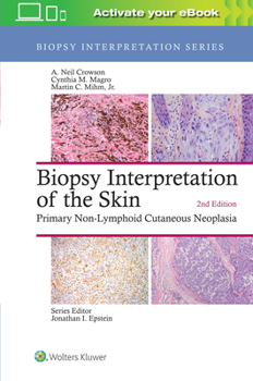 Hardcover Biopsy Interpretation of the Skin: Primary Non-Lymphoid Cutaneous Neoplasia Book