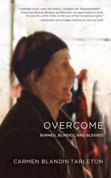 Paperback Overcome: Burned, Blinded, and Blessed Book