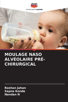 Moulage Naso Alvéolaire Pré-Chirurgical (French Edition)