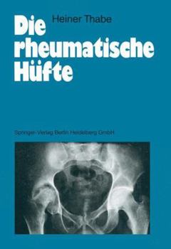 Paperback Die Rheumatische Hüfte [German] Book