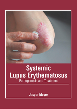 Hardcover Systemic Lupus Erythematosus: Pathogenesis and Treatment Book