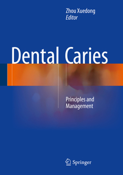 Hardcover Dental Caries: Principles and Management Book
