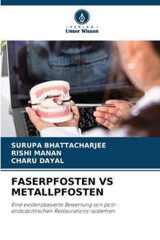 Faserpfosten Vs Metallpfosten (German Edition)