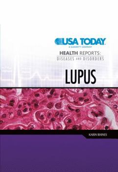 Lupus - Book  of the USA TODAY Health Reports: Diseases and Disorders