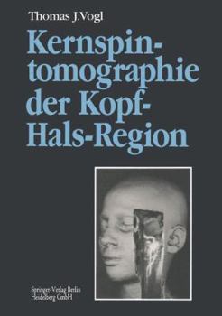 Paperback Kernspintomographie Der Kopf-Hals-Region: Funktionelle Topographie -- Klinische Befunde -- Bildgebung -- Spektroskopie [German] Book