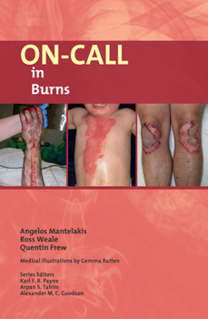 Paperback On-Call in Burns Book