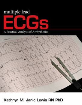Paperback Multiple Lead ECGs: A Practical Analysis of Arrhythmias Book