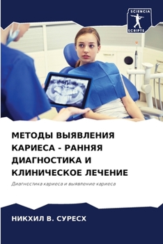 Paperback МЕТОДЫ ВЫЯВЛЕНИЯ КАРИЕС& [Russian] Book