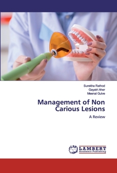 Paperback Management of Non Carious Lesions Book