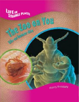 Library Binding Zoo on You: Life on Human Skin Book