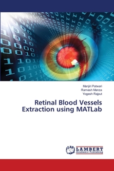 Paperback Retinal Blood Vessels Extraction using MATLab Book
