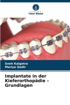 Paperback Implantate in der Kieferorthopädie - Grundlagen [German] Book