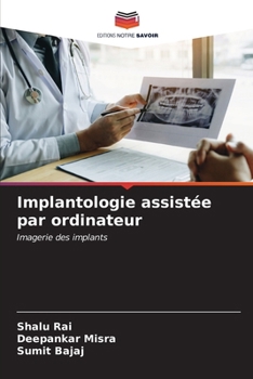 Paperback Implantologie assistée par ordinateur [French] Book