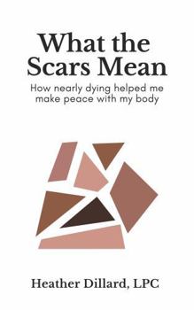 What the Scars Mean: How Nearly Dying Helped Me Make Peace With My Body
