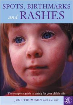 Paperback Spots, Birthmarks and Rashes: The Complete Guide to Caring for Your Child's Skin Book