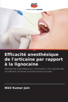 Paperback Efficacité anesthésique de l'articaïne par rapport à la lignocaïne [French] Book