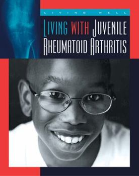 Library Binding Living with Juvenile Rheumatoid Arthritis Book