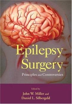 Hardcover Epilepsy Surgery: Principles and Controversies (Neurological Disease and Therapy) Book