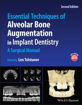 Hardcover Essential Techniques of Alveolar Bone Augmentation in Implant Dentistry: A Surgical Manual Book