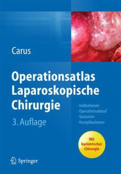 Hardcover Operationsatlas Laparoskopische Chirurgie: Indikationen - Operationsablauf - Varianten - Komplikationen [German] Book