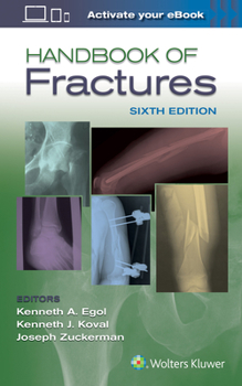 Paperback Handbook of Fractures Book