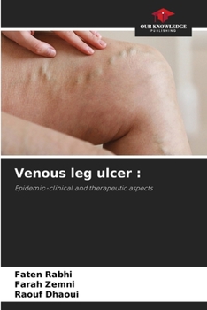 Paperback Venous leg ulcer Book
