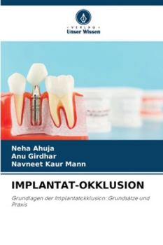 IMPLANTAT-OKKLUSION: Grundlagen der Implantatokklusion: Grundsätze und Praxis (German Edition)