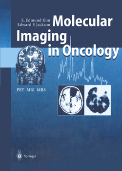 Paperback Molecular Imaging in Oncology: Pet, Mri, and Mrs Book