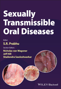 Paperback Sexually Transmissible Oral Diseases Book