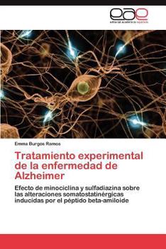 Paperback Tratamiento experimental de la enfermedad de Alzheimer [Spanish] Book