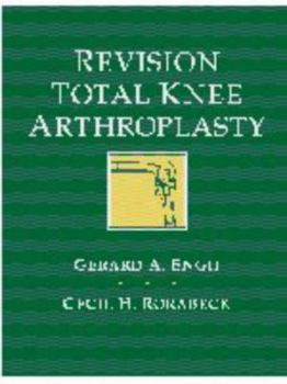 Hardcover Revision Total Knee Arthroplasty Book