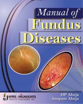 Hardcover Manual of Fundus Diseases Book