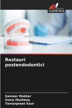 Paperback Restauri postendodontici [Italian] Book