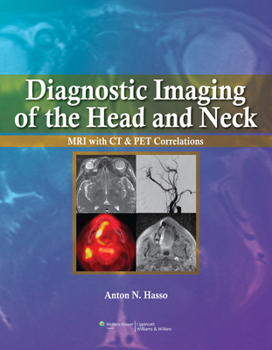 Diagnostic Imaging Of The Head And Neck: Mri With Ct & Pet Correlations (Hb-2012)