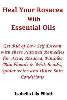 Heal Your Rosacea with Essential Oils : Get Rid of Low Self Esteem with These Natural Remedies for Acne, Rosacea, Pimples (Blackheads and Whiteheads), Spider Veins and Other Skin Conditions