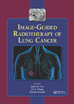 Hardcover Image-Guided Radiotherapy of Lung Cancer Book