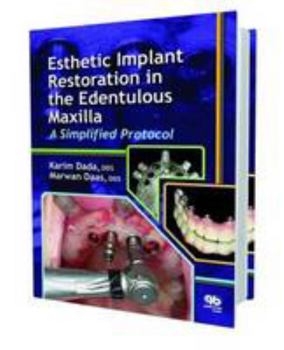 Hardcover Esthetic Implant Restoration in the Edentulous Maxilla: A Simplified Protocol Book