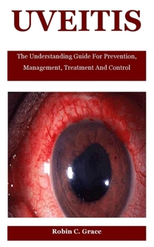 Paperback Uveitis: The Understanding Guide For Prevention, Management, Treatment And Control Book