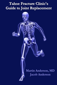 Paperback Tahoe Fracture Clinic's Guide to Joint Replacement Book