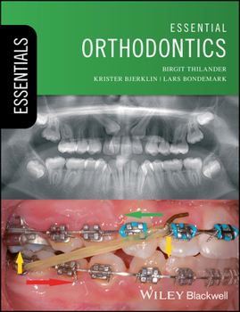 Paperback Essential Orthodontics Book